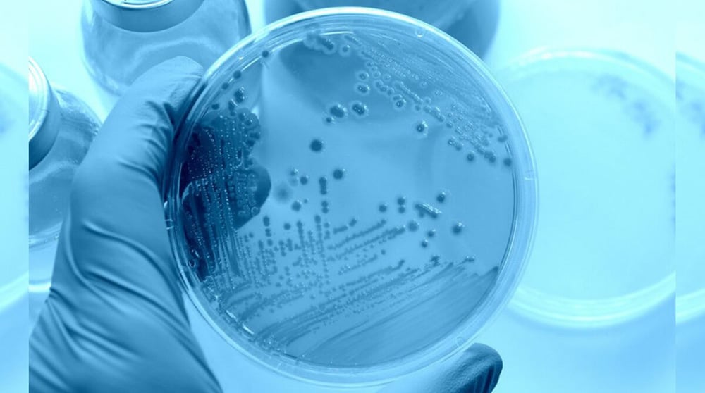 کنترل رشد باکتری‌ها در استخر